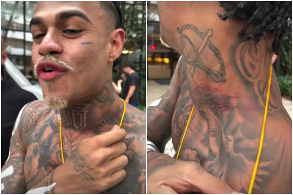  MC Cabelinho é ferido durante tentativa de roubo em Salvador